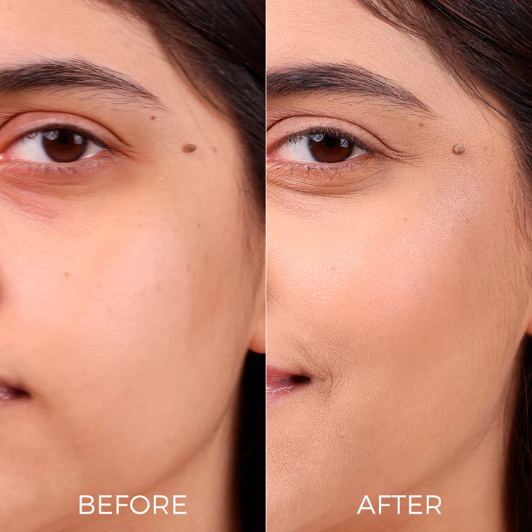 10% Niacinamide Face Serum for Smooth, Glowing Skin - Image 4