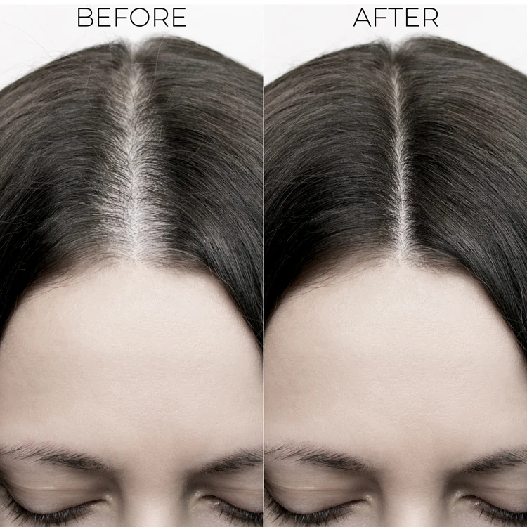 Hair Fall Control Conditioner To Reduce Seasonal Hair Fall - Image 4
