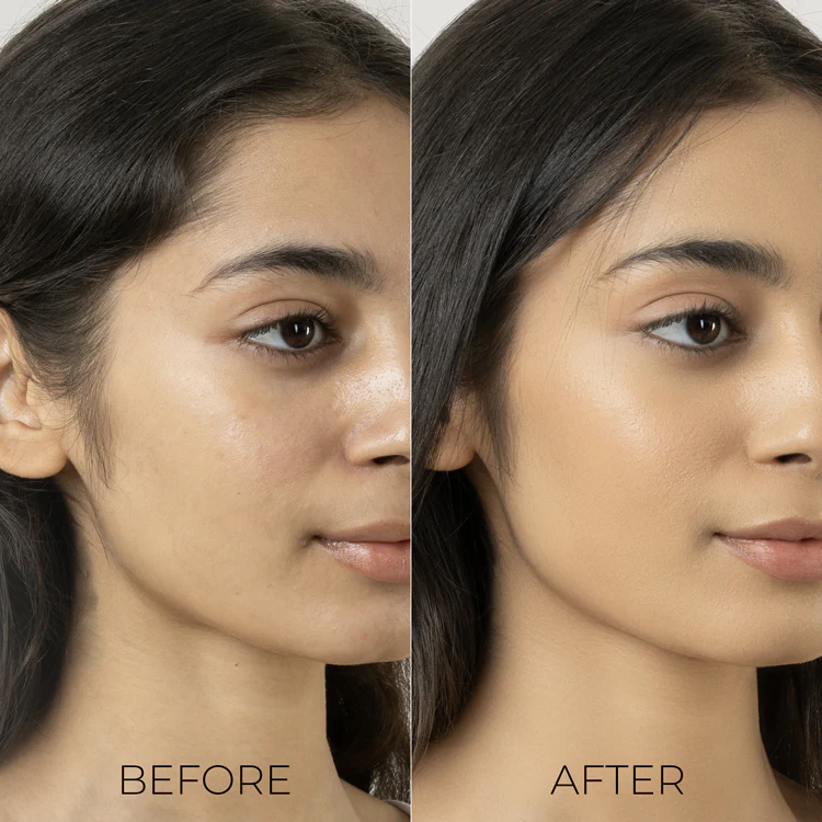 Oil Away Power Drops for Acne Prone Skin - Image 4