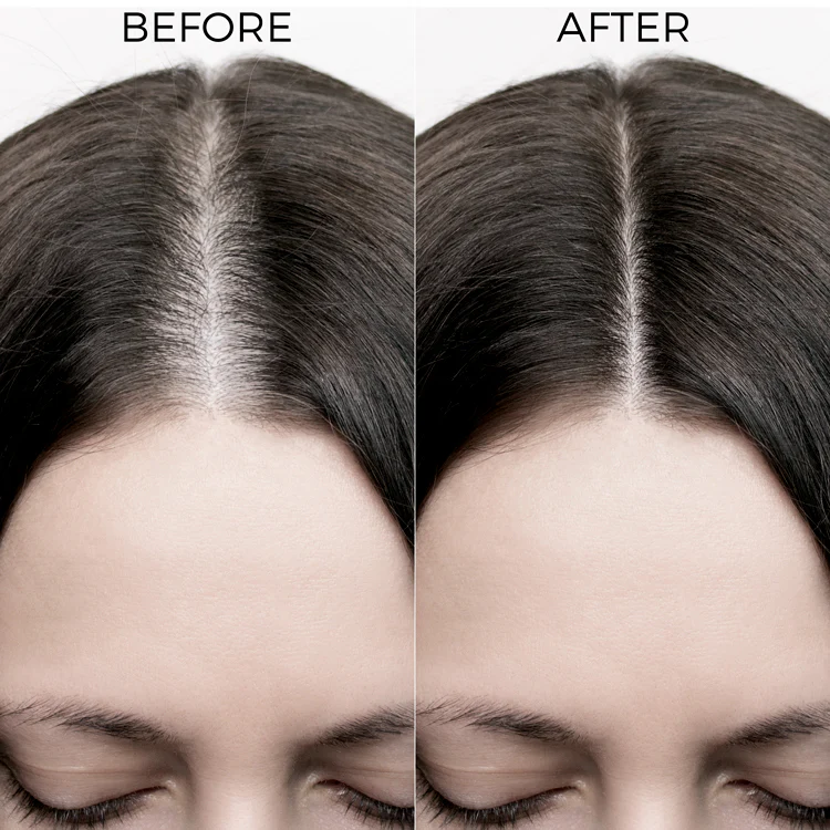 Rosemary Oil Shots with Shampoo For Visible Hair Growth - Image 11